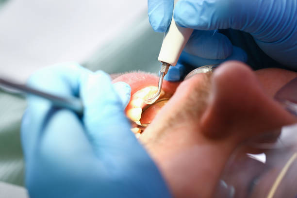 Best Emergency Treatment for Toothache in Auburn, KS
