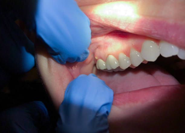 Best Emergency Root Canal Treatment in Auburn, KS