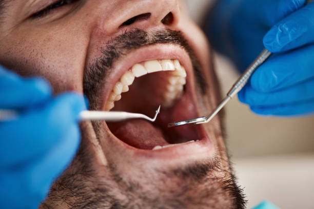 Best Emergency Dental Care for Trauma or Injury in Auburn, KS